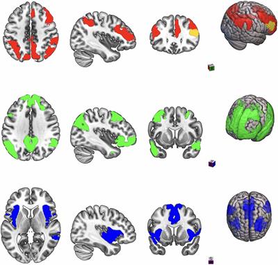 Transcranial direct current stimulation modulates working memory and prefrontal-insula connectivity after mild-moderate traumatic brain injury